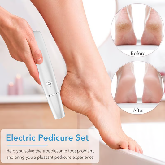 Father's Day Special🦶 Electric Foot Callus Remover