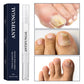 ✨New product launch🔥Toenail fungus treatment pen for damaged nails