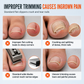 Stainless Steel Ingrown Toenail Clippers