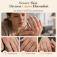Moisturizing Hydrating Hand Cream for Dry Cracked Skin